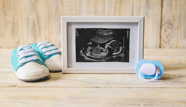 Immagine Ultrasuoni Della Fotografia Degli Accessori Bambino Concentrazione Selettiva Bambino — Foto Stock