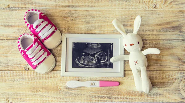 Imagen Ultrasonido Fotografía Accesorios Bebé Enfoque Selectivo Niño —  Fotos de Stock