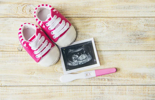 Immagine Ultrasuoni Della Fotografia Degli Accessori Bambino Concentrazione Selettiva Bambino — Foto Stock