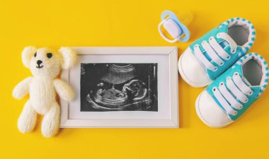 Bebeğin fotoğrafının ve aksesuarlarının ultrason fotoğrafı. Seçici odaklanma. çocuk.