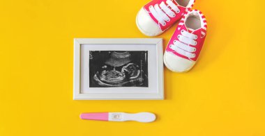 Bebeğin fotoğrafının ve aksesuarlarının ultrason fotoğrafı. Seçici odaklanma. çocuk.