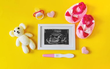 Bebeğin fotoğrafının ve aksesuarlarının ultrason fotoğrafı. Seçici odaklanma. çocuk.