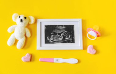 Bebeğin fotoğrafının ve aksesuarlarının ultrason fotoğrafı. Seçici odaklanma. çocuk.