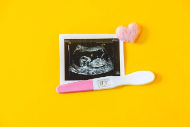 Bebeğin fotoğrafının ve aksesuarlarının ultrason fotoğrafı. Seçici odaklanma. çocuk.