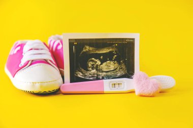 Bebeğin fotoğrafının ve aksesuarlarının ultrason fotoğrafı. Seçici odaklanma. çocuk.