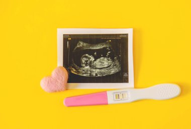 Bebeğin fotoğrafının ve aksesuarlarının ultrason fotoğrafı. Seçici odaklanma. çocuk.