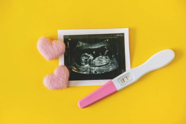 Bebeğin fotoğrafının ve aksesuarlarının ultrason fotoğrafı. Seçici odaklanma. çocuk.