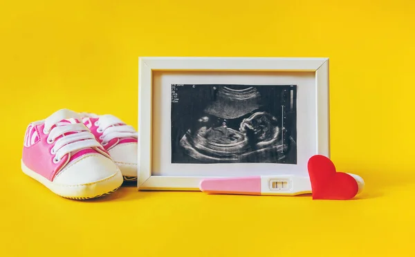 Imagen Ultrasonido Fotografía Accesorios Bebé Enfoque Selectivo Niño — Foto de Stock