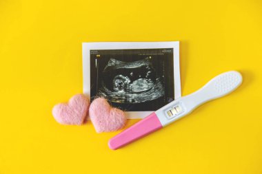 Bebeğin fotoğrafının ve aksesuarlarının ultrason fotoğrafı. Seçici odaklanma. çocuk.