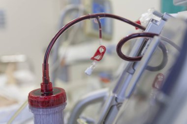 Hastanedeki yoğun bakım ünitesinde arka-Groud diyaliz makinesine bağlı diyalizör.