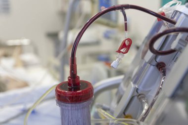 Hastanedeki yoğun bakım ünitesinde arka-Groud diyaliz makinesine bağlı diyalizör.