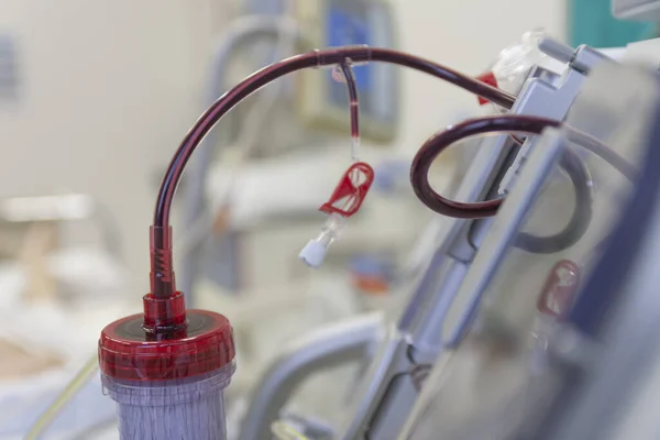 Dialysator Med Övre Port Backgrouddialysmaskin Intensiven Sjukhus — Stockfoto