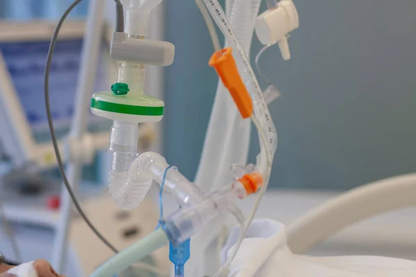 呼吸器接続管 Hmeフィルター 二酸化炭素センサー 吸引カテーテル 病院のIcuの医療用人工呼吸器に接続されている患者 — ストック写真