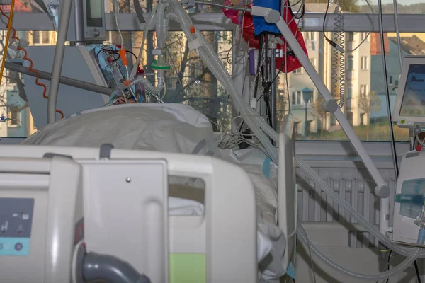 在医院里的重症监护病房 是一个可以治疗由考拉病毒引起的肺炎患者的地方 与医用通风机和透析机连接的病人 — 图库照片