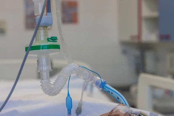 内視鏡チューブ Hmeフィルター 二酸化炭素センサー 病院のIcuの医療用人工呼吸器に接続されている患者 — ストック写真