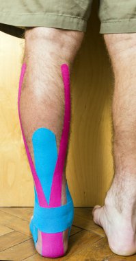 Leg covered colored tapes used in the rehabilitation of injuries clipart