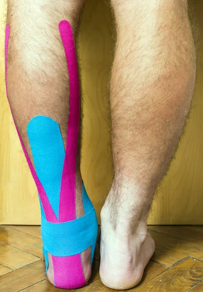 Il piede con una ferita ricoperta di nastro utilizzato nel nastro elastico terapeutico (Kinesio Taping ). — Foto Stock