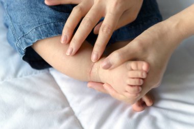 Annesi bir scracthing ayak bileği üzerinde olan bebeğin icabına