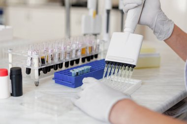 Tıbbi Ekipman, Kan ve Genetik Örnekler Laboratuvarda Biyoteknoloji ile çalışan doktor ellerinde