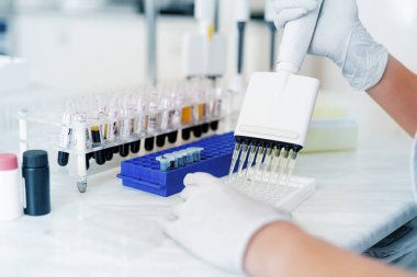 Tıbbi Ekipman, Kan ve Genetik Örnekler Laboratuvarda Biyoteknoloji ile çalışan doktor ellerinde