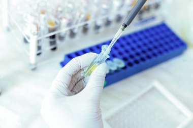 Bilim adamı elleri test tüpleri ile tıbbi ekipman, kan ve genetik örnekleri analiz