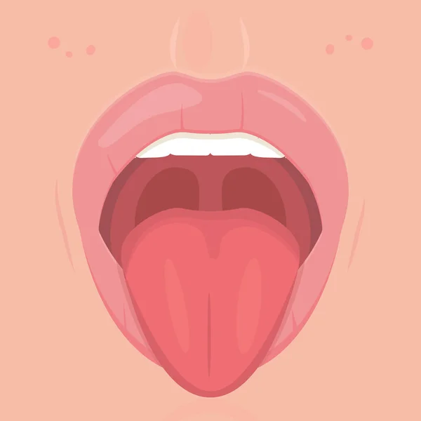 歯と舌で口を開けて。面白い表現を示す舌。医学ポスター、耳鼻咽喉科 — ストックベクタ
