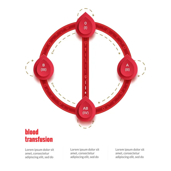 Gruppe und Typ infografisches Transfusionsprogramm für den Weltblutspendertag am 14. Juni. Medizinisches Poster — Stockvektor