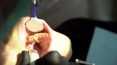 Diş sağlığı kliniğinde kadın hastalarla çalışan dişçi doktorları. 4k