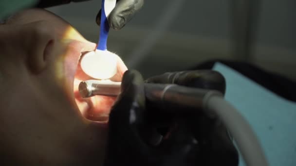 Οδοντίατροι Που Δουλεύουν Γυναίκα Ασθενή Στην Οδοντιατρική Κλινική 4Ια — Αρχείο Βίντεο