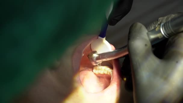 歯医者は歯科医院で女性患者と仕事をしている — ストック動画