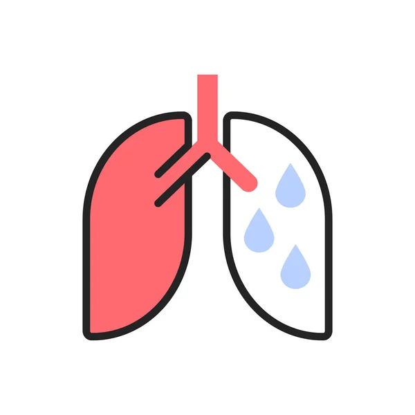 Hidrotórax, enfermedad pulmonar, pleuresía exudativa tipo ilustración plana — Archivo Imágenes Vectoriales