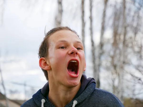2020年大自然中一个快乐的青春痘少年的肖像 — 图库照片