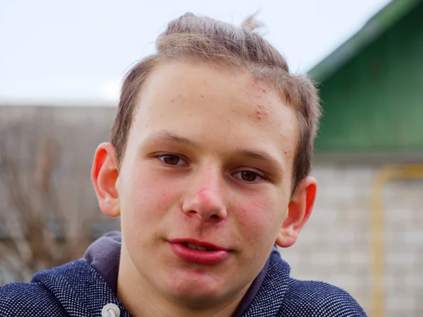 2020年大自然中一个快乐的青春痘少年的肖像 — 图库照片