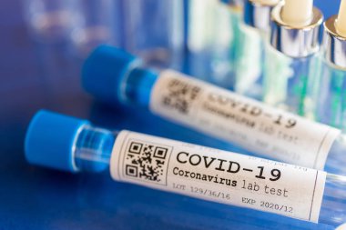 Tehlikeli Coronavirus Covid-19 virüsü laboratuvarda - 2019-nCoV virüsü enfeksiyonu. Koronavirüs salgını nedeniyle küresel salgın riski