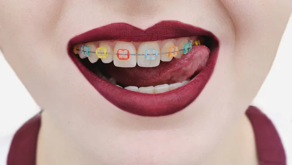 Vörös ajkak és a fehér fogak, a száj, nyelv Stock Fotó