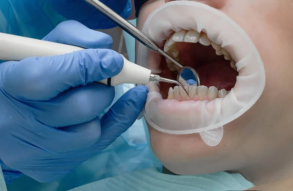 aletleri, cerrahi, diş hekimliği, diş