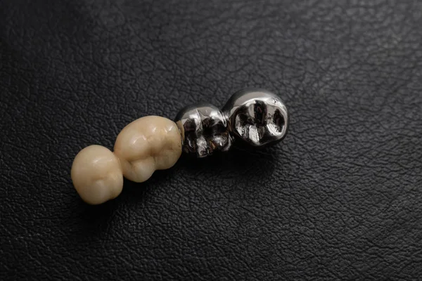 Oral kavite içinde ortopedik tasarım