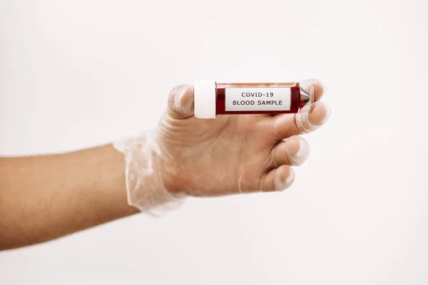 hand with glove taking a test tube with a blood sample infected with covid-19, medicine concept and protection against viruses and bacteria