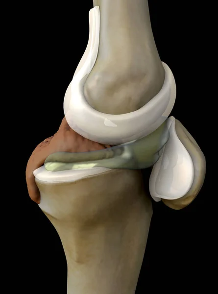 人間の膝の上の骨粗鬆症 — ストック写真