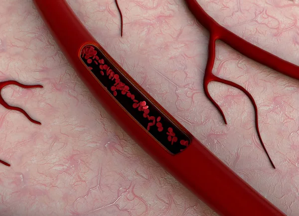 Illustrazione 3D dei vasi sanguigni — Foto Stock