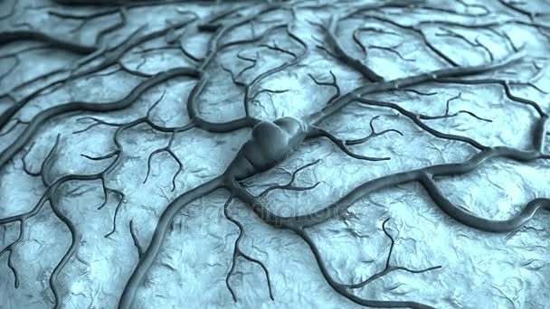 Capilar e acidente vascular cerebral — Vídeo de Stock