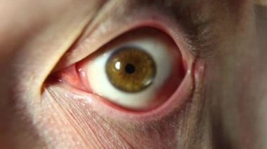 Göz göz küresi dönüşü. Etrafına bakıyor yanıp adam göz close-up, deli