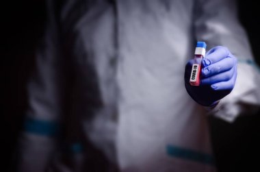 Doktorun elinde bir koronavirüs var. Salgın virüsünün tedavisinde kullanılan Covid-19 tıp eldiveni konseptini içeren bir kan testi.