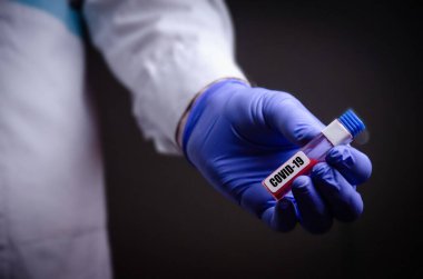 Doktorun elinde bir koronavirüs var. Salgın virüsünün tedavisinde kullanılan Covid-19 tıp eldiveni konseptini içeren bir kan testi.