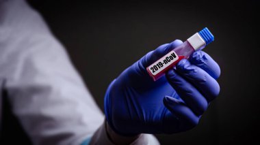 Doktorun elinde bir koronavirüs var. Salgın virüsünün tedavisinde kullanılan Covid-19 tıp eldiveni konseptini içeren bir kan testi.