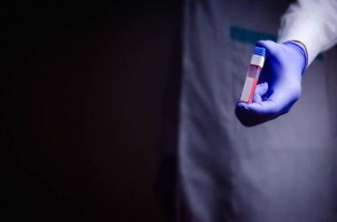 Doktorun elinde bir koronavirüs var. Salgın virüsünün tedavisinde kullanılan Covid-19 tıp eldiveni konseptini içeren bir kan testi.