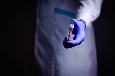 Doktorun elinde bir koronavirüs var. Salgın virüsünün tedavisinde kullanılan Covid-19 tıp eldiveni konseptini içeren bir kan testi.