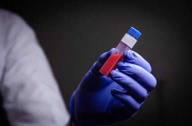 Doktorun elinde bir koronavirüs var. Salgın virüsünün tedavisinde kullanılan Covid-19 tıp eldiveni konseptini içeren bir kan testi.