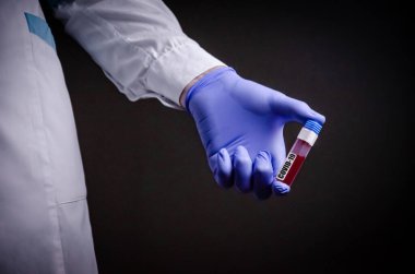 Doktorun elinde bir koronavirüs var. Salgın virüsünün tedavisinde kullanılan Covid-19 tıp eldiveni konseptini içeren bir kan testi.