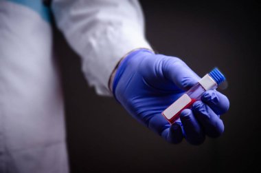 Doktorun elinde bir koronavirüs var. Salgın virüsünün tedavisinde kullanılan Covid-19 tıp eldiveni konseptini içeren bir kan testi.
